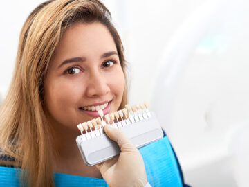 Dental Veneers before and after Care