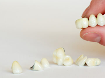 Dental Crowns and Oral Health: How They Protect and Strengthen Your Smile