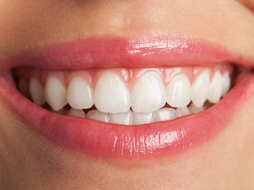 How Cosmetic Dentistry in Phoenix AZ Improves Stained Teeth