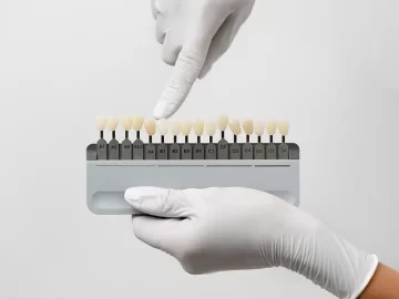 Fixing Gaps and Chips: How Dental Veneers Can Instantly Transform Your Smile